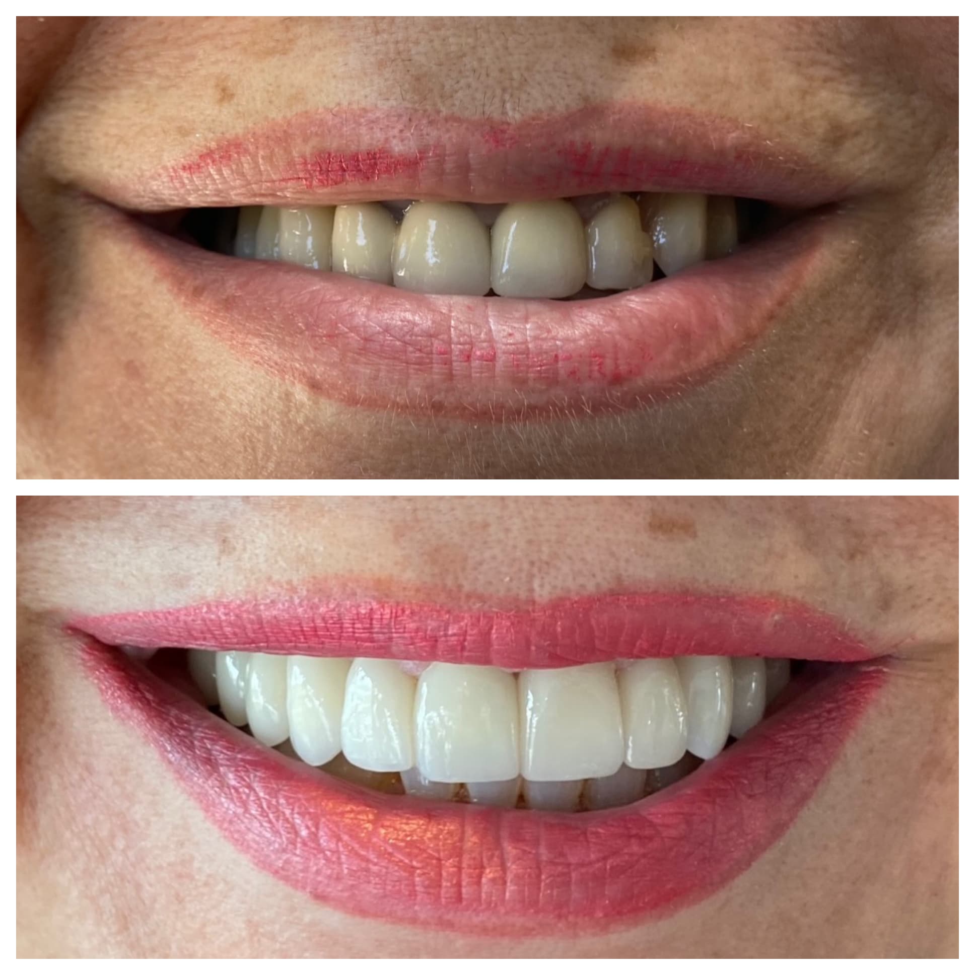 Patient outcome. Dr. Baradaran.